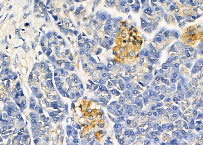 TAS2R43 Antibody in Immunohistochemistry (Paraffin) (IHC (P))