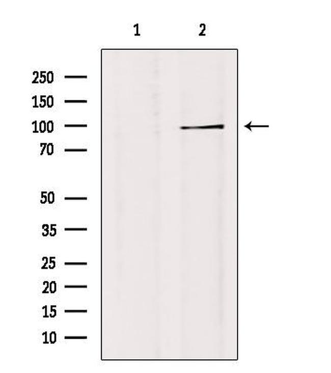 GTF3C3 Antibody in Western Blot (WB)