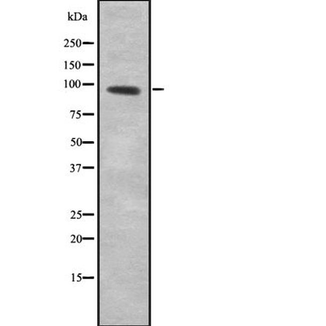 GTF3C4 Antibody in Western Blot (WB)