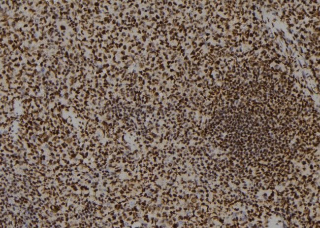 Phospho-FANCA (Ser1149) Antibody in Immunohistochemistry (Paraffin) (IHC (P))