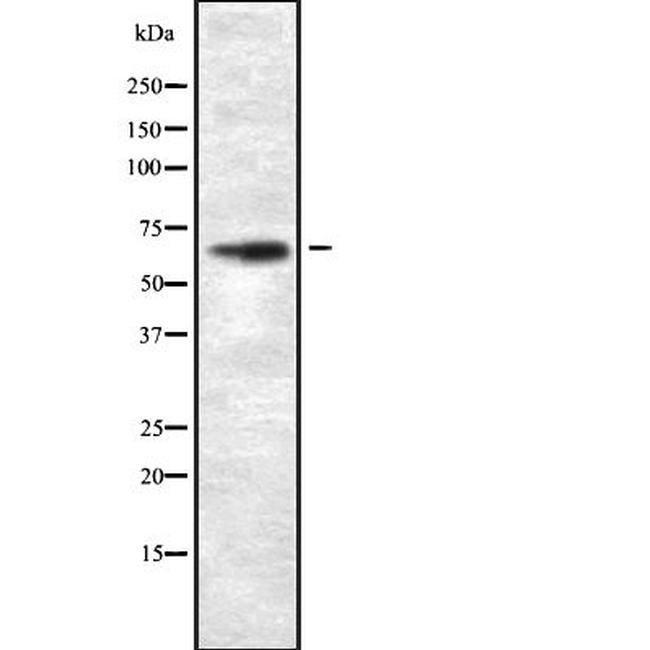 Herpes Simplex Virus Type 6A (strain Uganda-1102) Antibody in Western Blot (WB)