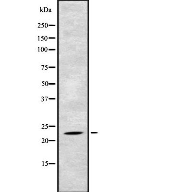 TAF10 Antibody in Western Blot (WB)