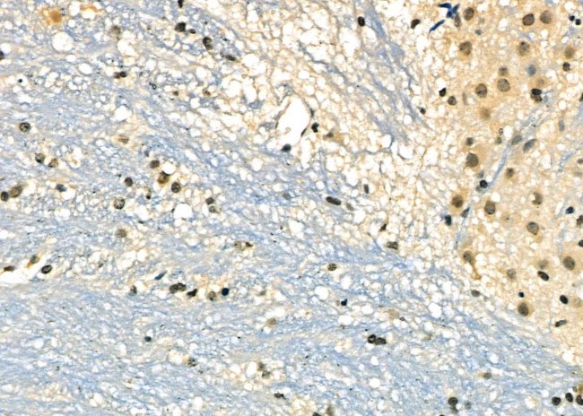 DMP1 Antibody in Immunohistochemistry (Paraffin) (IHC (P))