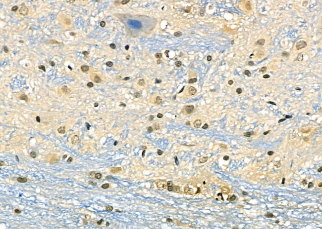 DMP1 Antibody in Immunohistochemistry (Paraffin) (IHC (P))