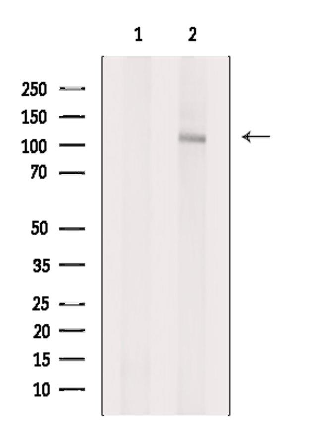 TSHZ1 Antibody in Western Blot (WB)