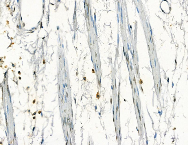 GTF2H4 Antibody in Immunohistochemistry (Paraffin) (IHC (P))