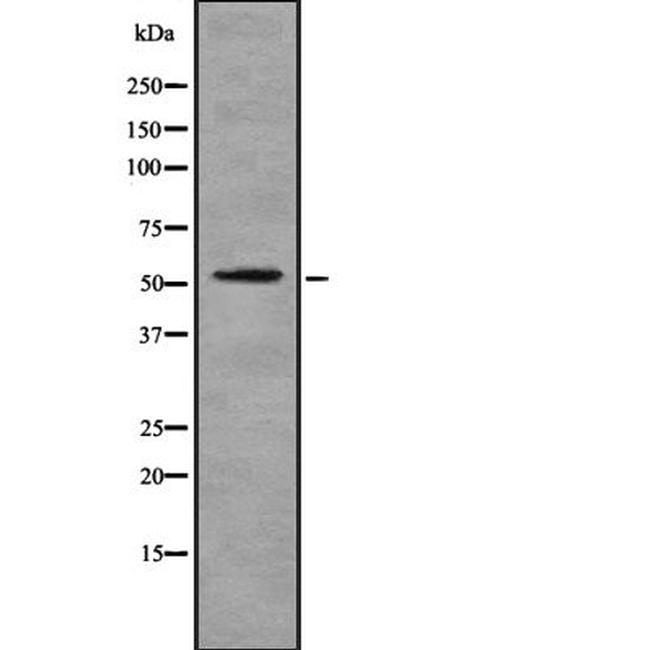 GTF2H4 Antibody in Western Blot (WB)