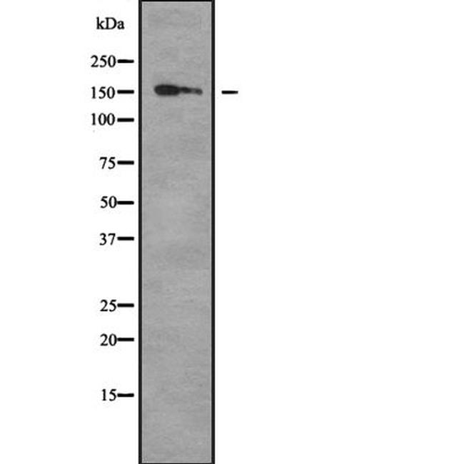 COL16A1 Antibody in Western Blot (WB)