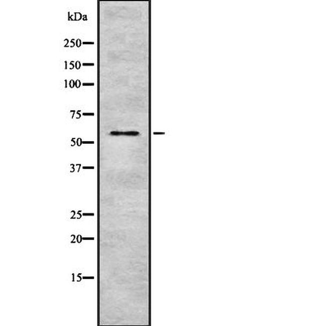 CYP4F8 Antibody in Western Blot (WB)