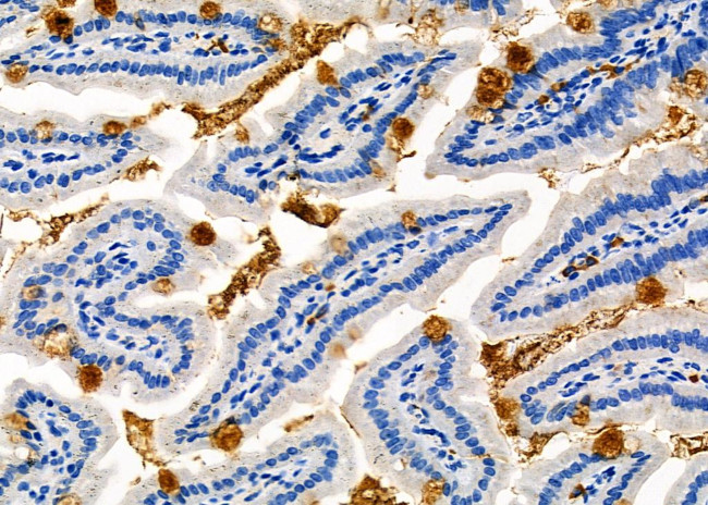 CRLF1 Antibody in Immunohistochemistry (Paraffin) (IHC (P))