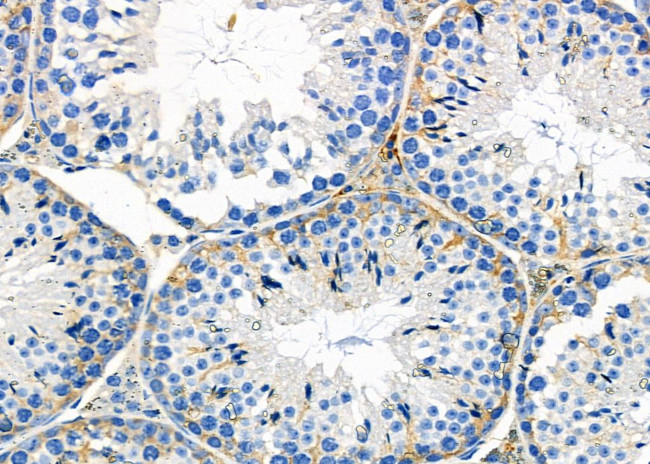 CRLF1 Antibody in Immunohistochemistry (Paraffin) (IHC (P))