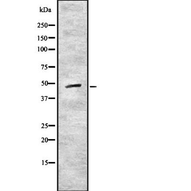 CRLF1 Antibody in Western Blot (WB)