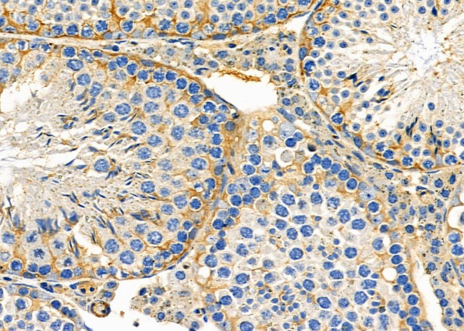 CRLF3 Antibody in Immunohistochemistry (Paraffin) (IHC (P))