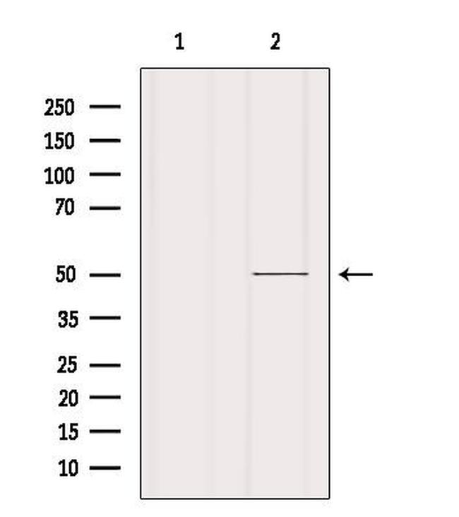 CRLF3 Antibody in Western Blot (WB)