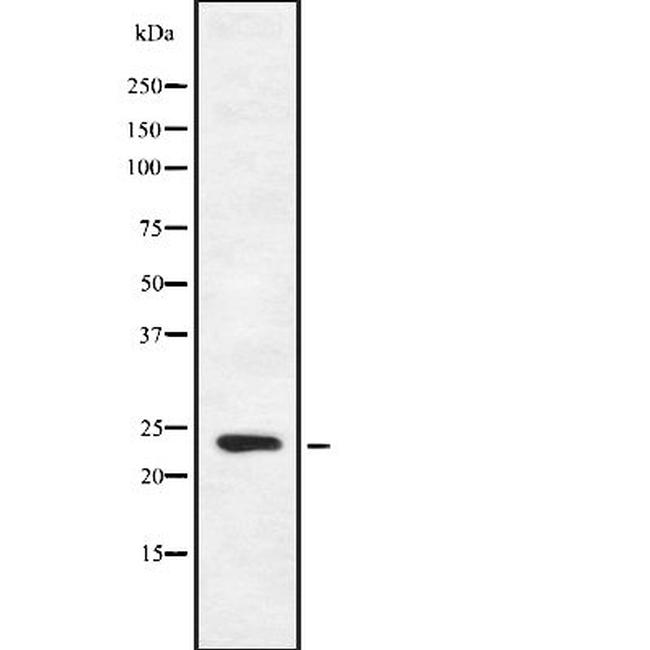 FGF16 Antibody in Western Blot (WB)