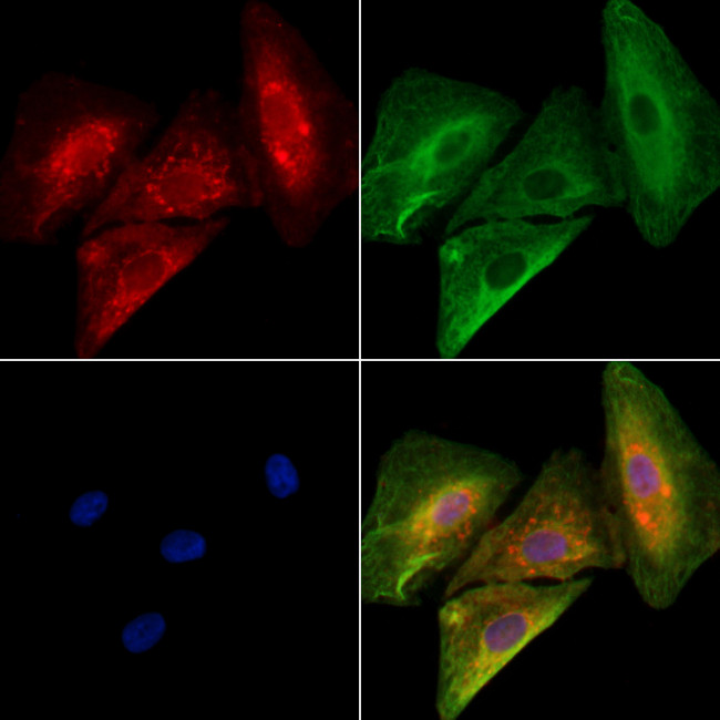 FGF20 Antibody in Immunocytochemistry (ICC/IF)