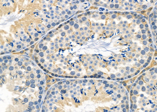 FGF20 Antibody in Immunohistochemistry (Paraffin) (IHC (P))