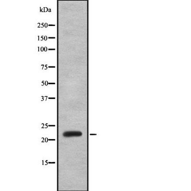 Interferon alpha-8 Antibody in Western Blot (WB)