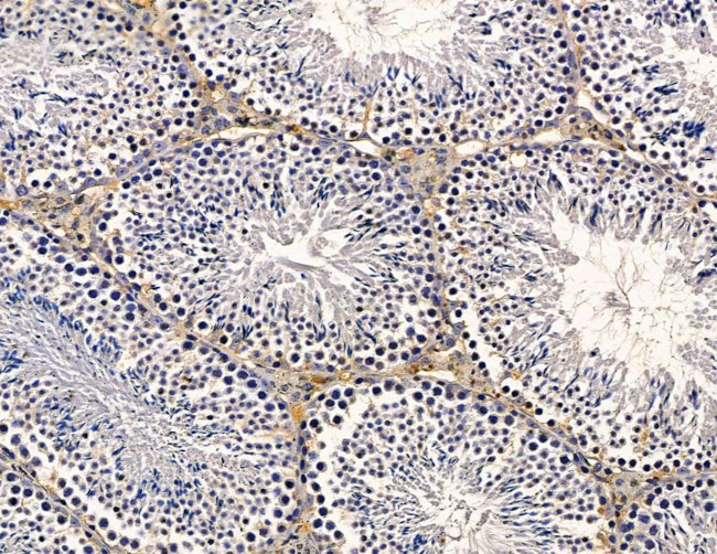 LAMTOR2 Antibody in Immunohistochemistry (Paraffin) (IHC (P))