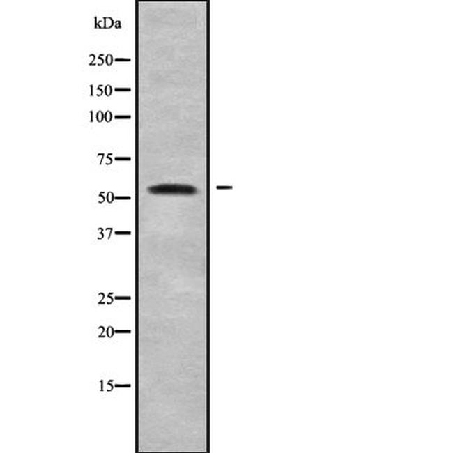 ALPPL2 Antibody in Western Blot (WB)