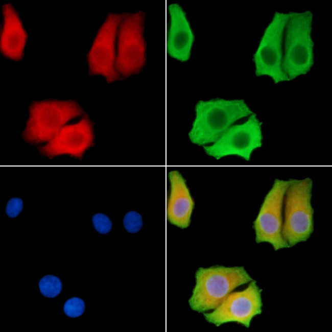 AGPAT1 Antibody in Immunocytochemistry (ICC/IF)