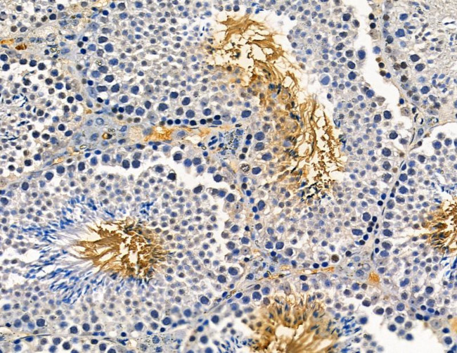 AGPAT1 Antibody in Immunohistochemistry (Paraffin) (IHC (P))