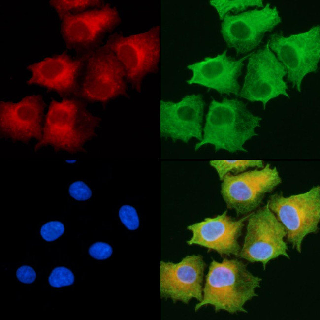 ABHD10 Antibody in Immunocytochemistry (ICC/IF)