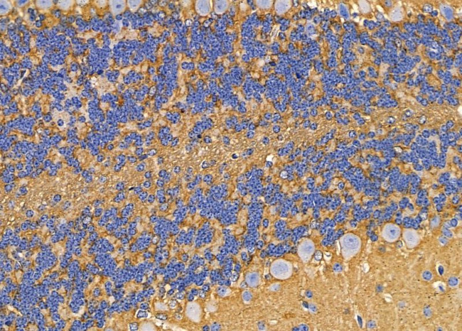 ABHD10 Antibody in Immunohistochemistry (Paraffin) (IHC (P))