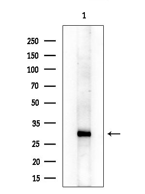 ABHD10 Antibody in Western Blot (WB)