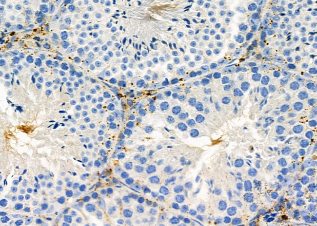 CHRNG Antibody in Immunohistochemistry (Paraffin) (IHC (P))