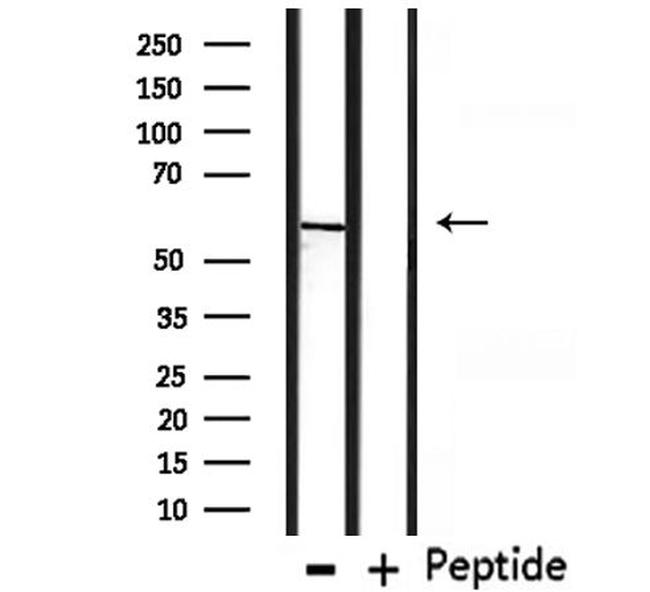 CHRNG Antibody in Western Blot (WB)