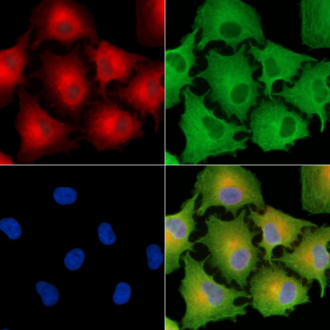 LPGAT1 Antibody in Immunocytochemistry (ICC/IF)