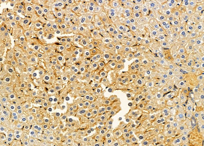 LPGAT1 Antibody in Immunohistochemistry (Paraffin) (IHC (P))