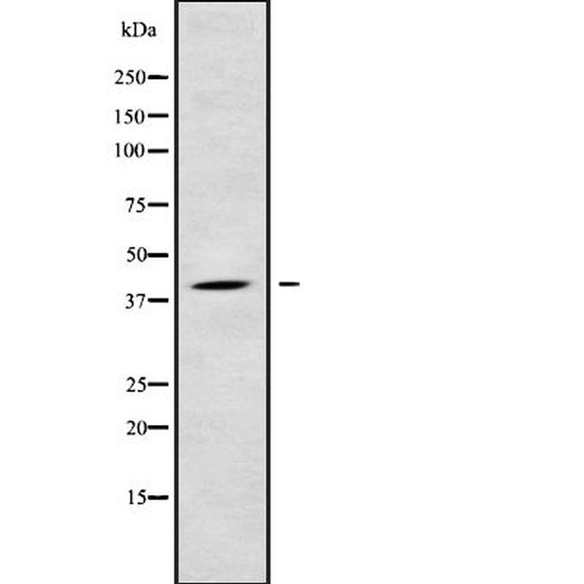 LPGAT1 Antibody in Western Blot (WB)