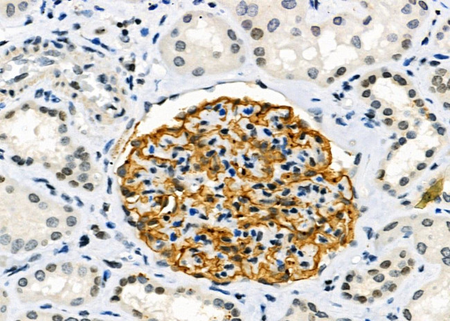 AOAH Antibody in Immunohistochemistry (Paraffin) (IHC (P))