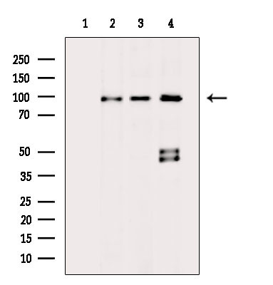 ADAM30 Antibody in Western Blot (WB)