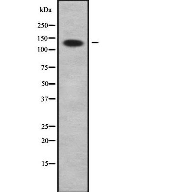 ADAMTS2 Antibody in Western Blot (WB)
