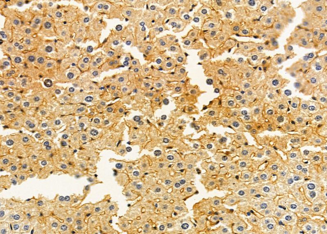 ALDH3B2 Antibody in Immunohistochemistry (Paraffin) (IHC (P))