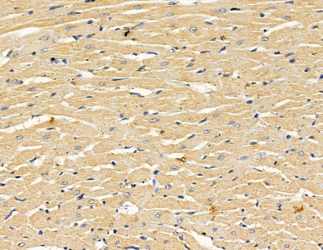 ALDH3B2 Antibody in Immunohistochemistry (Paraffin) (IHC (P))