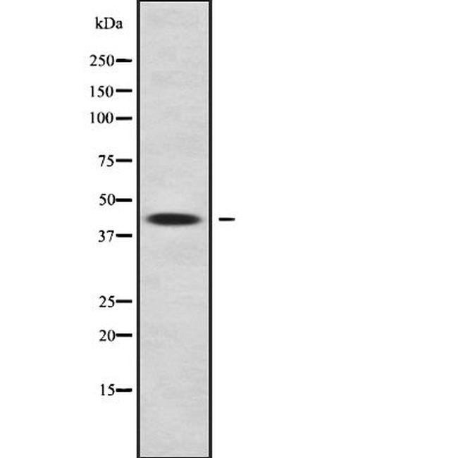 ALDH3B2 Antibody in Western Blot (WB)