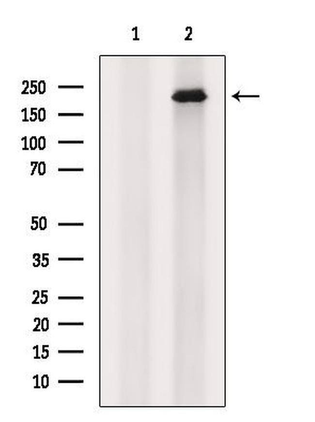 ALMS1 Antibody in Western Blot (WB)