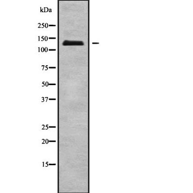 SLC4A3 Antibody in Western Blot (WB)