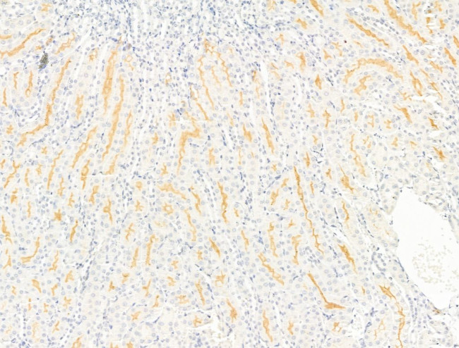 SLC4A9 Antibody in Immunohistochemistry (Paraffin) (IHC (P))