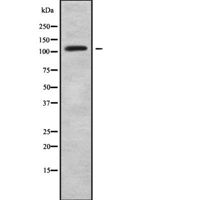 SLC4A9 Antibody in Western Blot (WB)