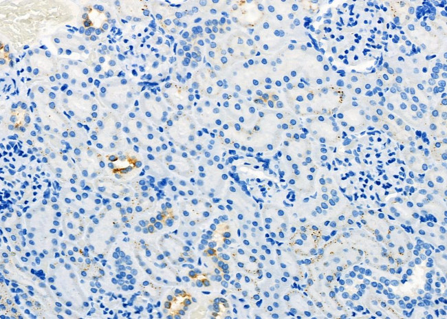 Aquaporin 11 Antibody in Immunohistochemistry (Paraffin) (IHC (P))