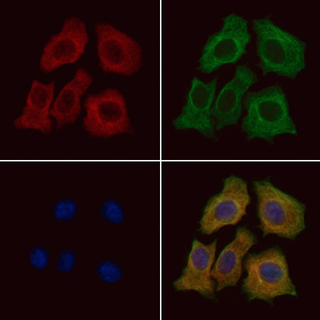 Aquaporin 11 Antibody in Immunocytochemistry (ICC/IF)