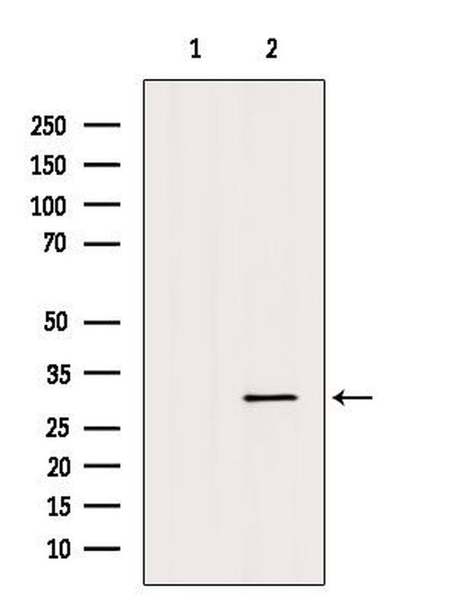 Aquaporin 11 Antibody in Western Blot (WB)