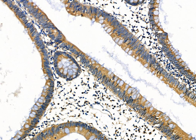 ARSH Antibody in Immunohistochemistry (Paraffin) (IHC (P))