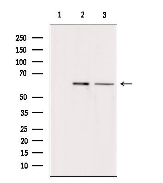 ARSH Antibody in Western Blot (WB)