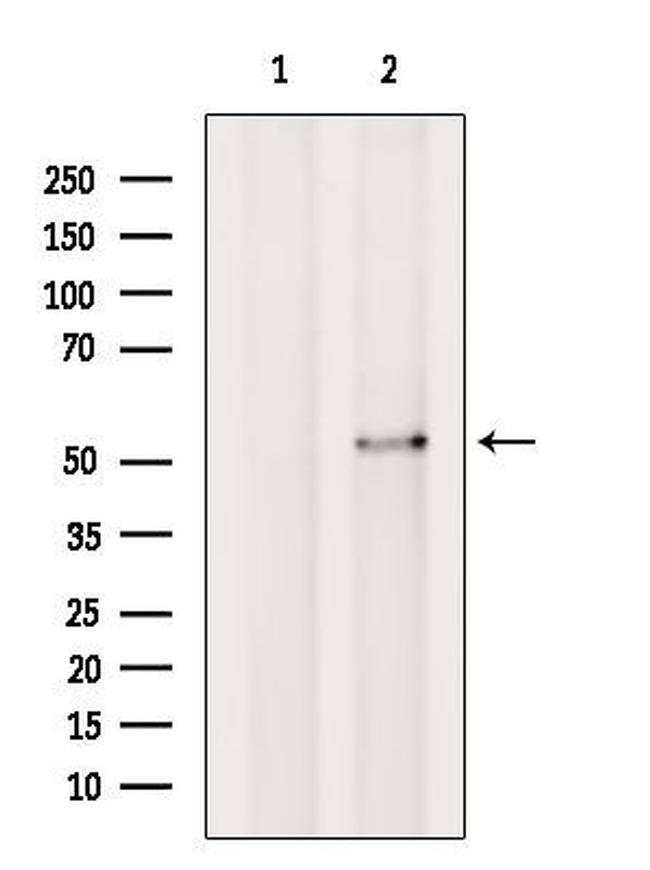 ATXN10 Antibody in Western Blot (WB)